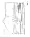 Fig. 02 - Tow hook cover having tether hook