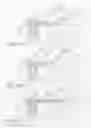 Fig. 04 - Foundation stabilization system for manufactured housing