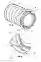 Fig. 09 - Filter element with features to improve pre-cleaning performance, sealing, and structural support