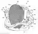 Fig. 01 - Spherical gear
