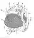 Fig. 02 - Spherical gear