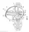 Fig. 09 - Spherical gear