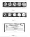 Fig. 03 - Method for completely dissolving and rapidly hydrolyzing cellulose, and uses of said method