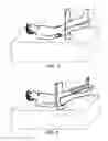 Fig. 04 - SURGICAL DRAPE TO FACILITATE EXTREMITY SURGERY