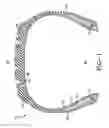 Fig. 02 - TIRES WITH HIGH STRENGTH REINFORCEMENT