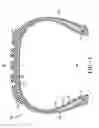 Fig. 02 - TIRES WITH HIGH STRENGTH REINFORCEMENT