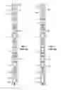 Fig. 05 - System and method for stimulating multiple production zones in a wellbore with a tubing deployed ball seat