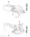 Fig. 05 - Tripod and transport pack assembly