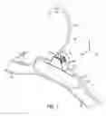 Fig. 02 - GARMENT HANGER WITH REUSABLE LOWER NECK SIZER
