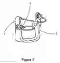 Fig. 04 - Casting Post