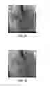 Fig. 04 - Method and system for efficient extraction of a silhouette of a 3D mesh