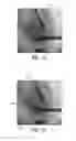 Fig. 08 - Method and system for efficient extraction of a silhouette of a 3D mesh