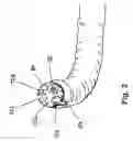 Fig. 03 - Navigation of endoscopic devices by means of eye-tracker