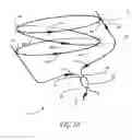 Fig. 07 - Method of using a unidirectional crow gyroscope