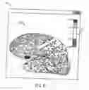 Fig. 06 - System and method for analyzing and visualizing local clinical features