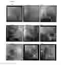 Fig. 07 - Method and system for detection and tracking of coronary sinus catheter electrodes in fluoroscopic images