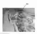 Fig. 01 - Method and system for vascular landmark detection