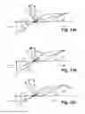Fig. 09 - Wind turbine blade