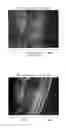 Fig. 01 - ACTIVATOR INCLUDING BIOSURFACTANT AS ACTIVE INGREDIENT, MANNOSYL ERYTHRITOL LIPID, AND PRODUCTION METHOD THEREOF