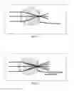 Fig. 02 - Method of treating ocular disorders