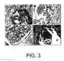 Fig. 04 - METHODS AND COMPOSITIONS RELATED TO PREFOLDIN AND ITS REGULATION