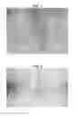 Fig. 04 - METHODS AND COMPOSITIONS FOR TREATING PSORIASIS
