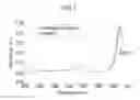 Fig. 06 - NEGATIVE ACTIVE MATERIAL FOR RECHARGEABLE LITHIUM BATTERY AND RECHARGEABLE LITHIUM BATTERY INCLUDING THE SAME