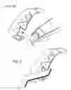 Fig. 06 - Dental implant locating device and method of use.
