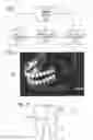 Fig. 02 - Dental implant fabrication and insertion methods and personalized dental implant for use therein