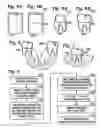 Fig. 03 - Dental implant fabrication and insertion methods and personalized dental implant for use therein