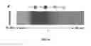 Fig. 07 - Lateral flow microfluidic assaying device and related method