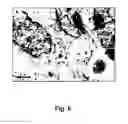 Fig. 07 - Tumor cell-derived microvesicles