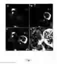 Fig. 08 - Tumor cell-derived microvesicles