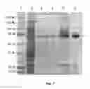 Fig. 17 - Bacterial cells, optimized nucleotide sequences and methods for improved expression of recombinant toxin B