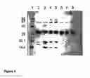 Fig. 05 - Variant form of urate oxidase and use thereof