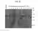 Fig. 06 - Targeted gene modification by parvoviral vectors