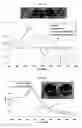 Fig. 13 - LABEL-FREE METHOD FOR DETECTING PRESENCE OR ABSENCE OF NUCLEIC ACIDS
