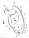 Fig. 02 - Collapsible flotation device