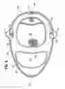 Fig. 06 - Collapsible flotation device