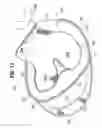 Fig. 15 - Collapsible flotation device