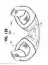 Fig. 17 - Collapsible flotation device