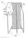 Fig. 01 - Surface treatment device