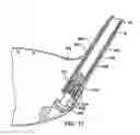 Fig. 10 - Golf club