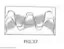 Fig. 44 - METHOD FOR MODIFYING AN AUTOMATIC TRANSMISSION AND GEAR TRAIN