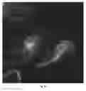 Fig. 07 - POLYMERIZATION-BASED AMPLIFICATION FOR IMMUNOSTAINING AND BIODETECTION