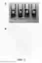 Fig. 08 - Microarray system