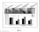 Fig. 09 - COMPOSITION OF INHIBITING PATHOLOGICAL ANGIOGENESIS