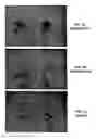 Fig. 03 - MODIFIED VEGF-A WITH IMPROVED ANGIOGENIC PROPERTIES