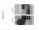 Fig. 09 - Recombinant soluble truncated IL-23 receptor (IL-23R) capable of inhibiting IL-23R-mediated cell signaling