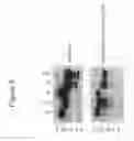 Fig. 14 - Recombinant soluble truncated IL-23 receptor (IL-23R) capable of inhibiting IL-23R-mediated cell signaling